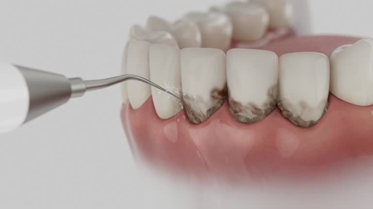 Trusted Teeth Cleaning And Checkup service in Trappe, MD - Dentist Open Now